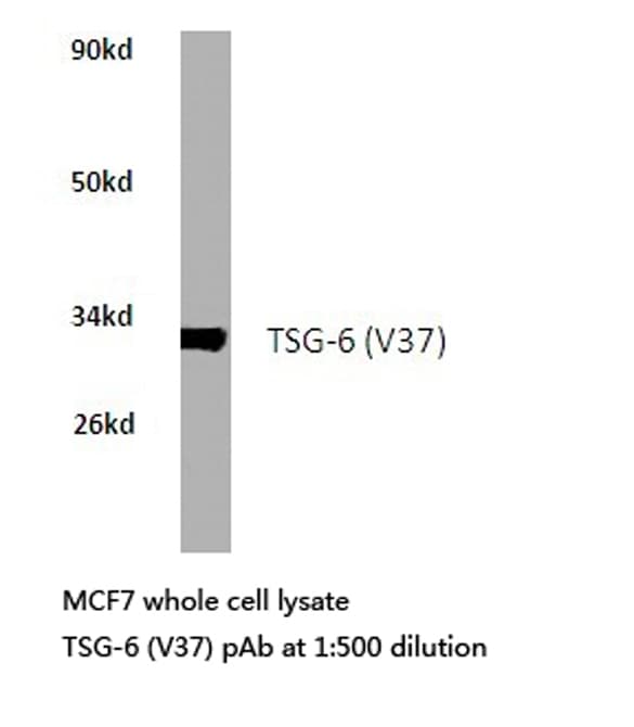 TNFAIP6 / TSG-6 Antibody (Val37)