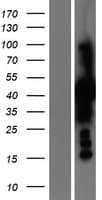 PSAT1 Protein (Over-Expression Lysate Myc-DDK (Flag))