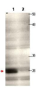 Polyclonal Rabbit anti-Human CENPQ Antibody (IF, WB)