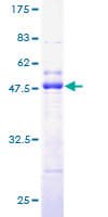 Human TCAP / Telethonin Protein (Recombinant GST)
