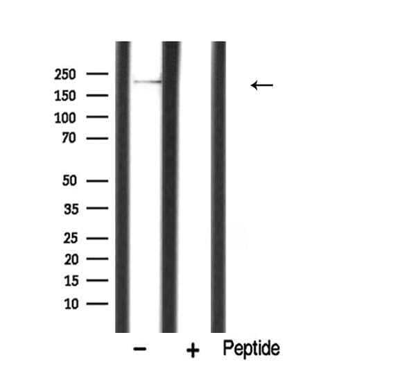 Polyclonal Rabbit anti-Human MYLK Antibody (WB)