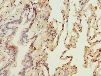 Polyclonal Rabbit anti-Human Osteoglycin / Mimecan Antibody (IHC)
