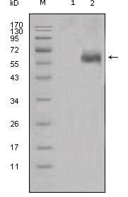 DKK1 Antibody (clone 2H2)