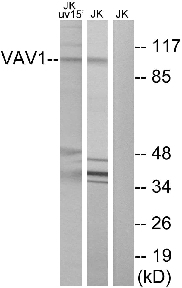 VAV1 / VAV Antibody (aa141-190)