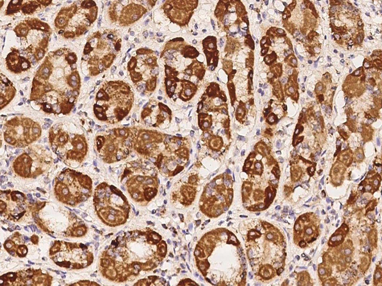 NDUFA3 / B9 Antibody