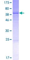 Human AUP1 Protein (Recombinant GST)