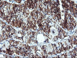 NCAM / CD56 Antibody (aa20-718, clone 1G4, Carrier-free)