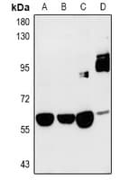 SRPK3 / MSSK1 Antibody
