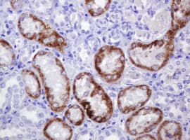 AMACR / P504S Antibody (clone OTI5F10)