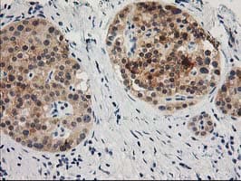 TOMM34 Antibody (clone OTI2A9, Carrier-free)