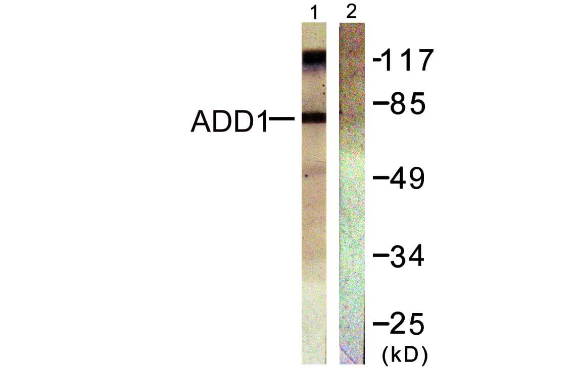 ADD1 / Adducin Alpha Antibody (p726)
