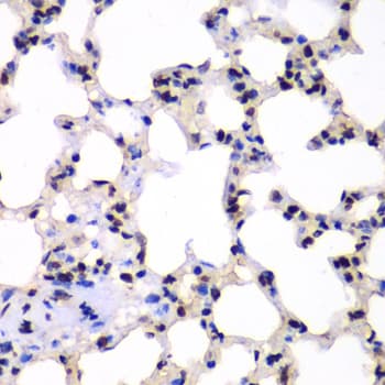 HR6B / UBE2B Antibody