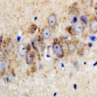 KCNJ3 / GIRK1 Antibody (phospho-Ser185)