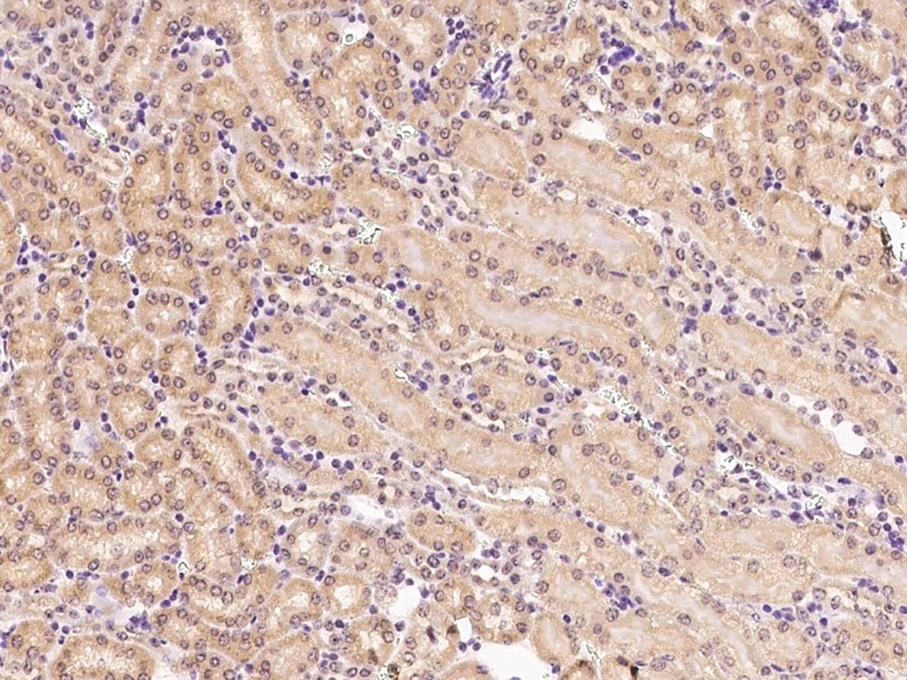 ELAVL1 / HUR Antibody