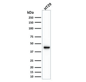 KRT20 / CK20 / Cytokeratin 20 Antibody (clone KRT20/1991)