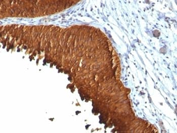 KRT19 / CK19 / Cytokeratin 19 Antibody (clone KRT19/799 + KRT19/800, Azide-free, BSA-free)