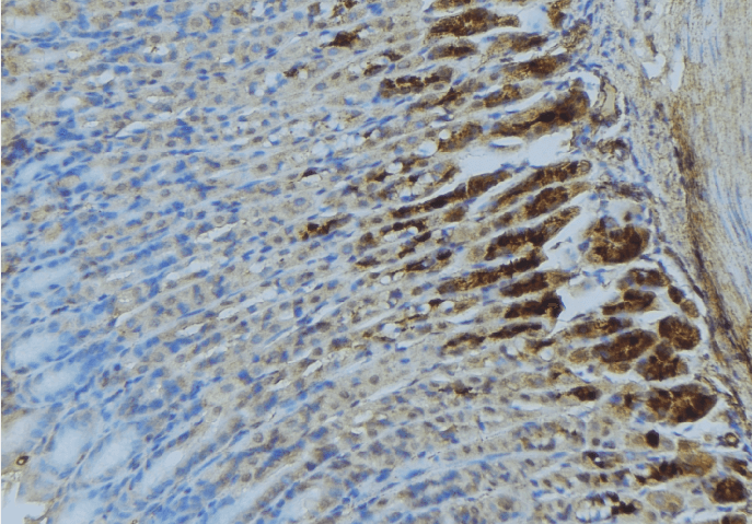 Polyclonal Rabbit anti-Human LRPAP1 Antibody (IHC, WB)