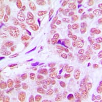 KAT2B / PCAF Antibody (C-Terminus)