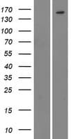 CML / BCR Protein (Over-Expression Lysate Myc-DDK (Flag))