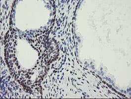 MEIS3 Antibody (aa1-261, clone OTI1B2)