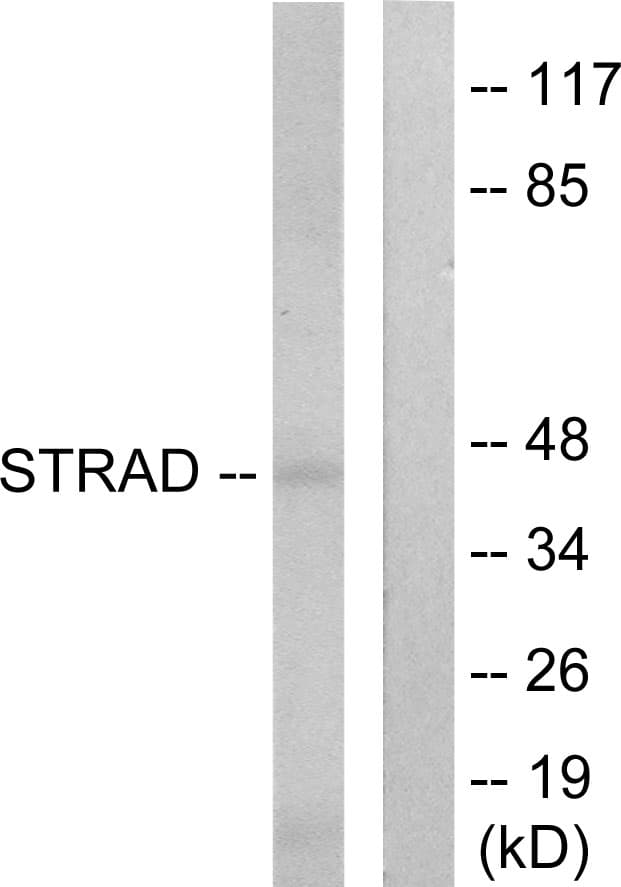 STRADA / LYK5 Antibody (aa11-60)
