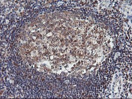 LIMK1 / LIMK Antibody (clone OTI8C8)