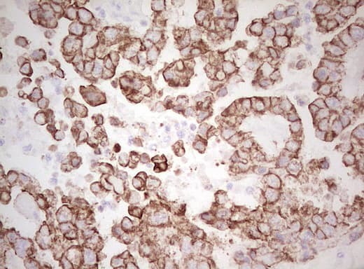 Basic Cytokeratin AE3 Antibody (clone AE3)
