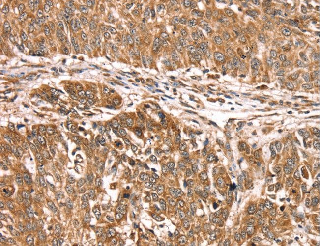 PDLIM4 / RIL Antibody