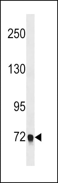 Polyclonal Rabbit anti-Human EPB41L5 Antibody (aa355-383, WB)