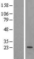 Human PEMT Protein (Over-Expression Lysate Myc-DDK (Flag))