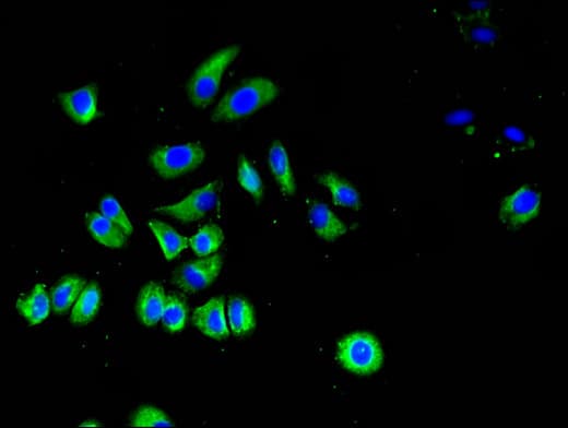 SLC40A1 / Ferroportin-1 Antibody