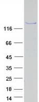 Human SPT5 / SUPT5H Protein (Recombinant Myc-DDK (Flag))