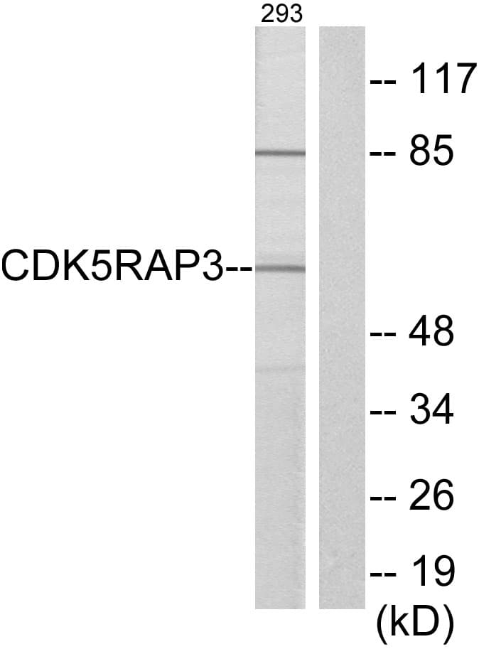 IHC-plus™ Polyclonal Rabbit anti-Human CDK5RAP3 Antibody (aa341-390, IHC, WB)