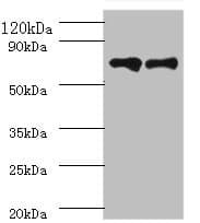 KLKB1 / Plasma Kallikrein Antibody