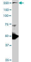 IHC-plus™ TLN1 / Talin 1 Antibody (clone 2E10)