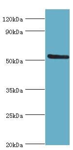 ALG1 Antibody (aa215-464)