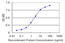ILKAP Antibody (clone 3B5)