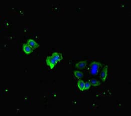 PDGF-D Antibody