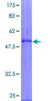 Human DKK4 Protein (Recombinant GST)