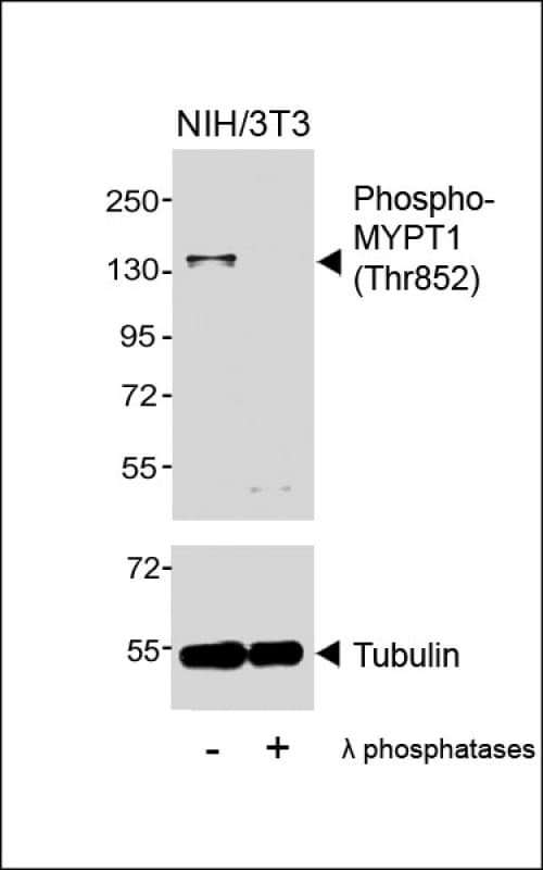 PPP1R12A / MYPT1 Antibody (phospho-Thr852)