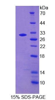 Human MPG Protein (Recombinant His)