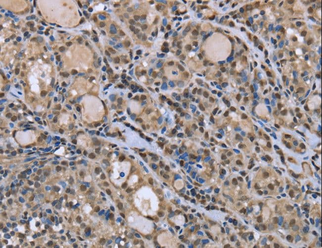 DYNLL1 / PIN Antibody