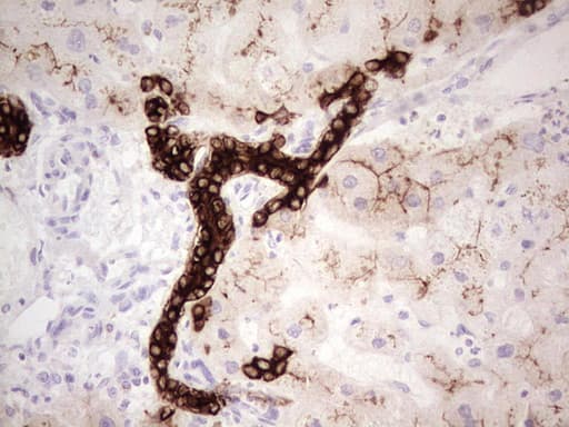 ABCB1 / MDR1 / P Glycoprotein Antibody (aa995-1280, clone OTI8A9)