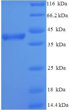 Human ACRV1/Intra-Acrosomal Protein (Recombinant His-SUMO)
