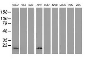 Monoclonal Mouse anti-Human DSTN / Destrin Antibody (clone OTI1B8, IHC, WB)
