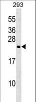 Polyclonal Rabbit anti-Human N6AMT1 Antibody (aa1-30, WB)