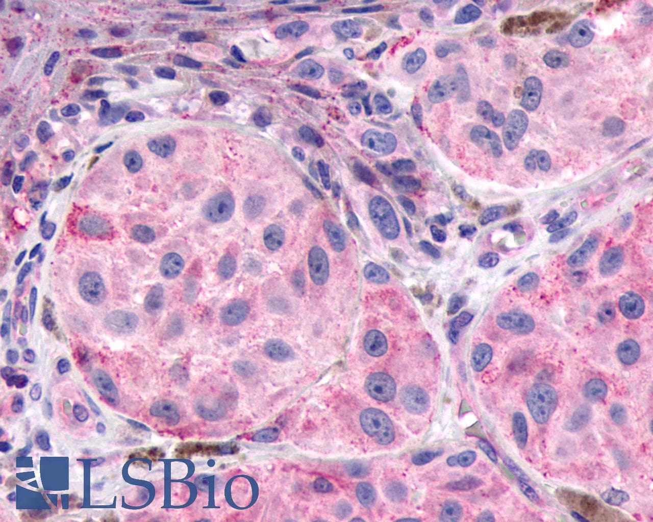 PathPlus™ TACR2 / NK2R Antibody (C-Terminus)