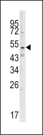 SMYD3 Antibody (aa7-35)