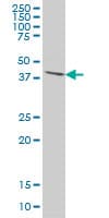Monoclonal Mouse anti-Human OVCA1 / DPH1 Antibody (clone 2C5, IF, WB)