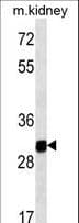 GNPDA1 Antibody